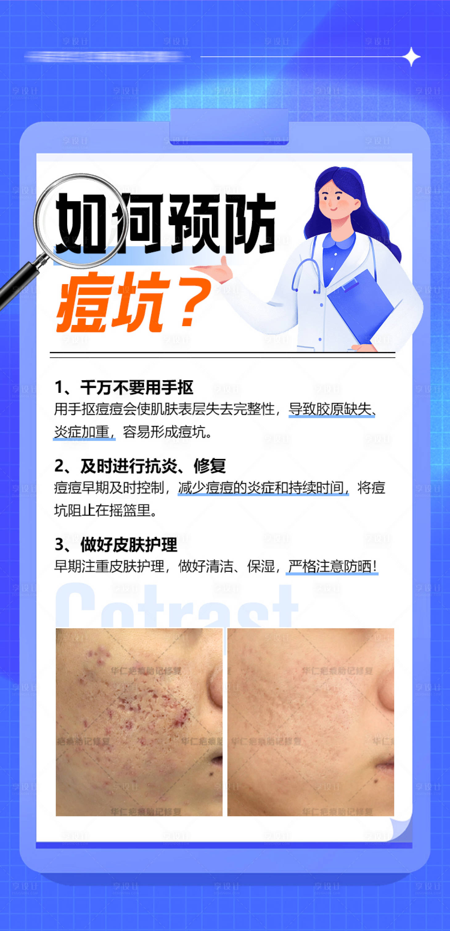 源文件下载【享设计】搜索编号：65750025315975212【医美祛痘科普人物案例海报】