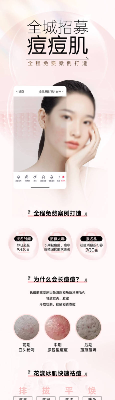 源文件下载【痘痘肌】编号：13590025082603921