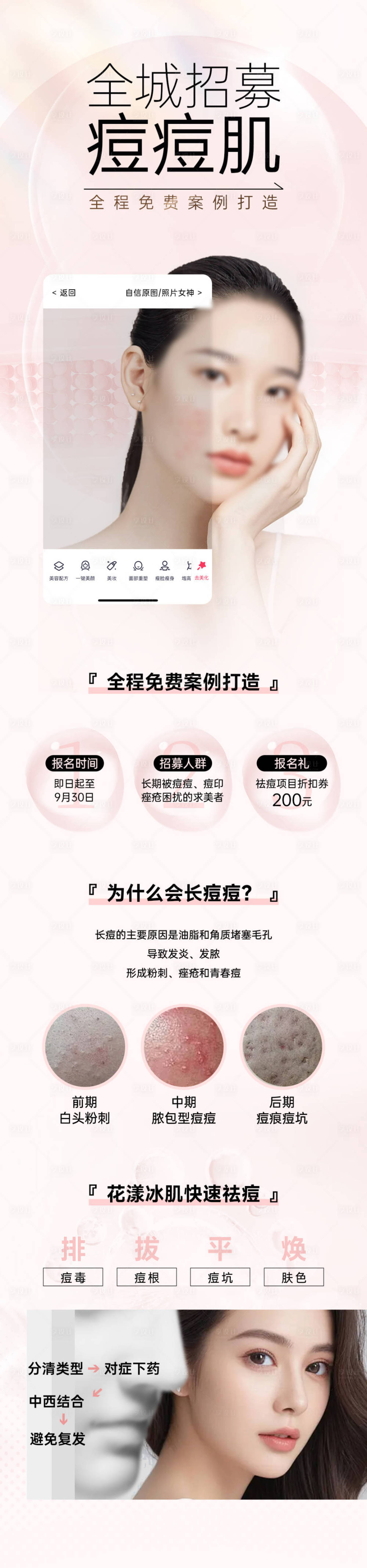 源文件下载【享设计】搜索编号：13590025082603921【痘痘肌】