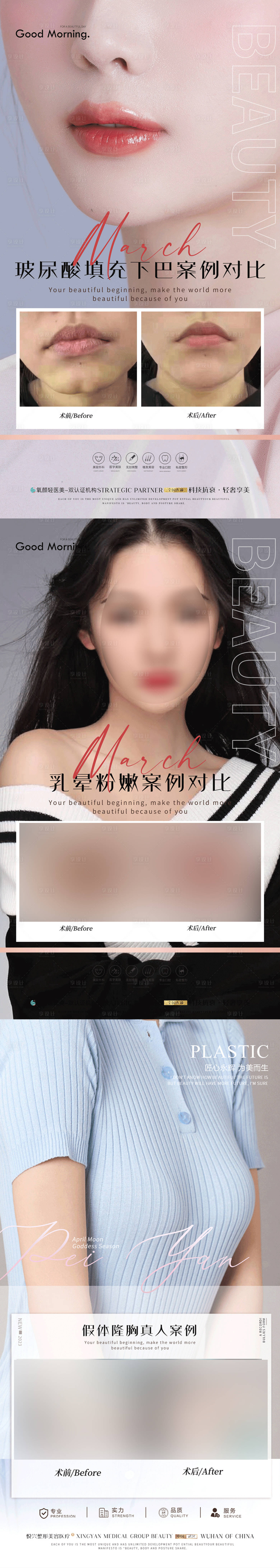 源文件下载【享设计】搜索编号：86140018844369987【整形案例系列海报】