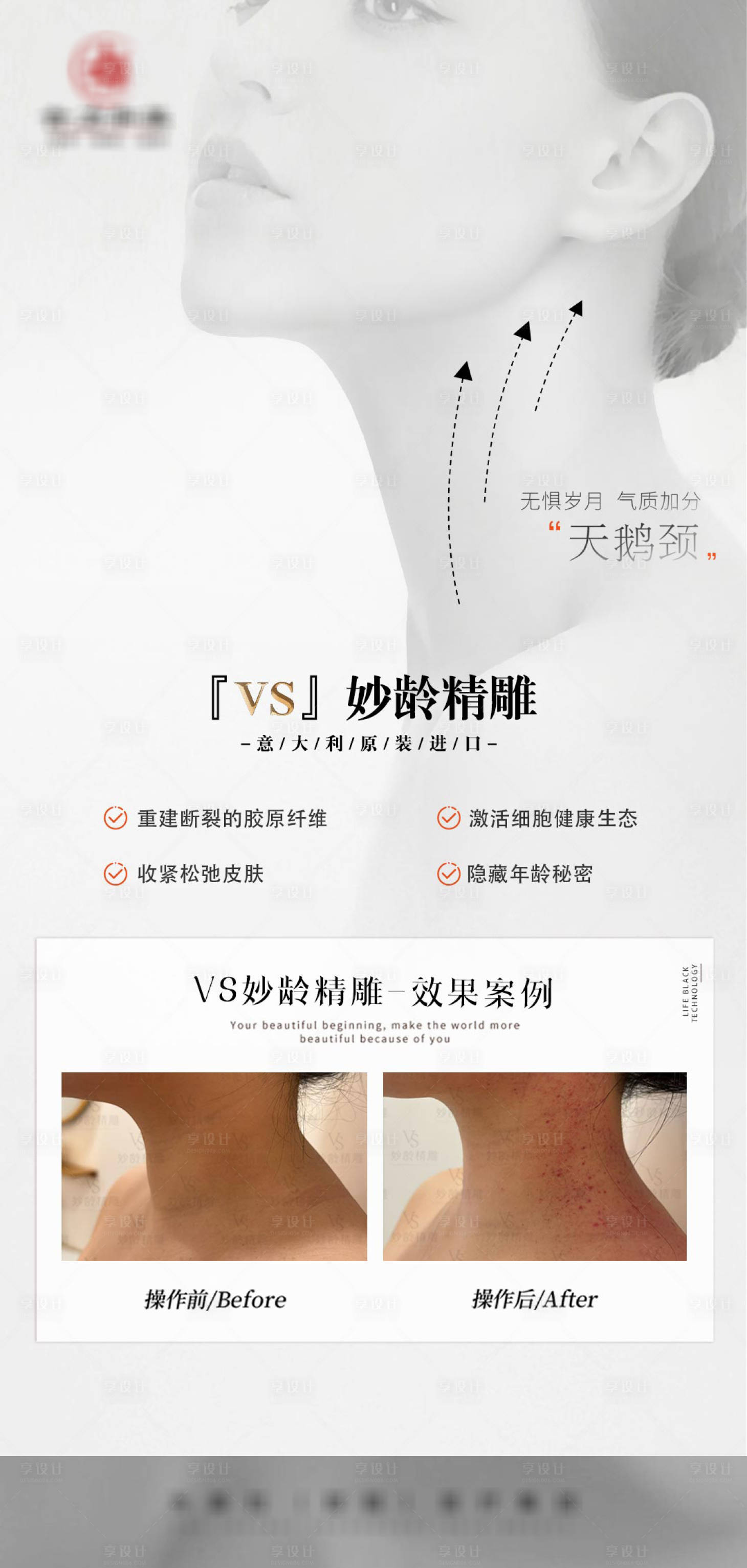 源文件下载【天鹅颈】编号：70700024886862193