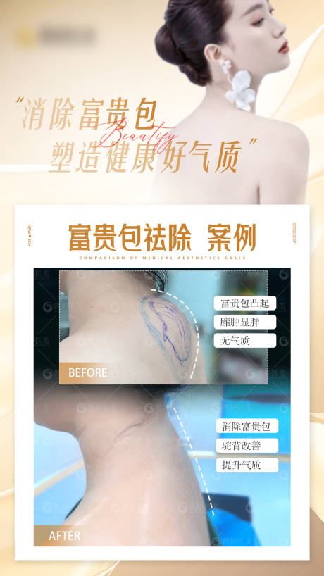 源文件下载【享设计】搜索编号：87560025033342478【富贵包医美案例对比图】
