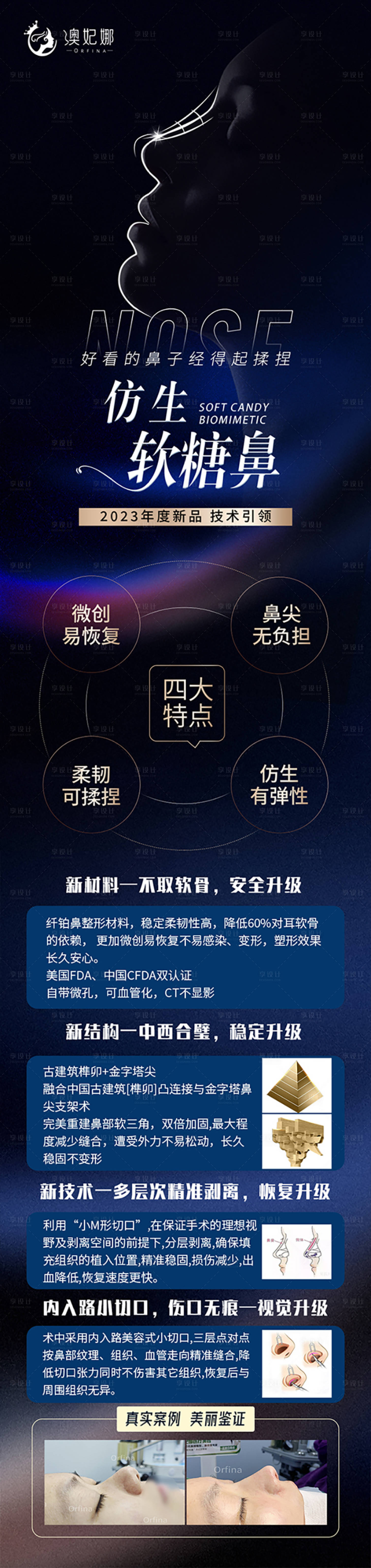 源文件下载【享设计】搜索编号：29580024965028194【医美鼻整形长图】