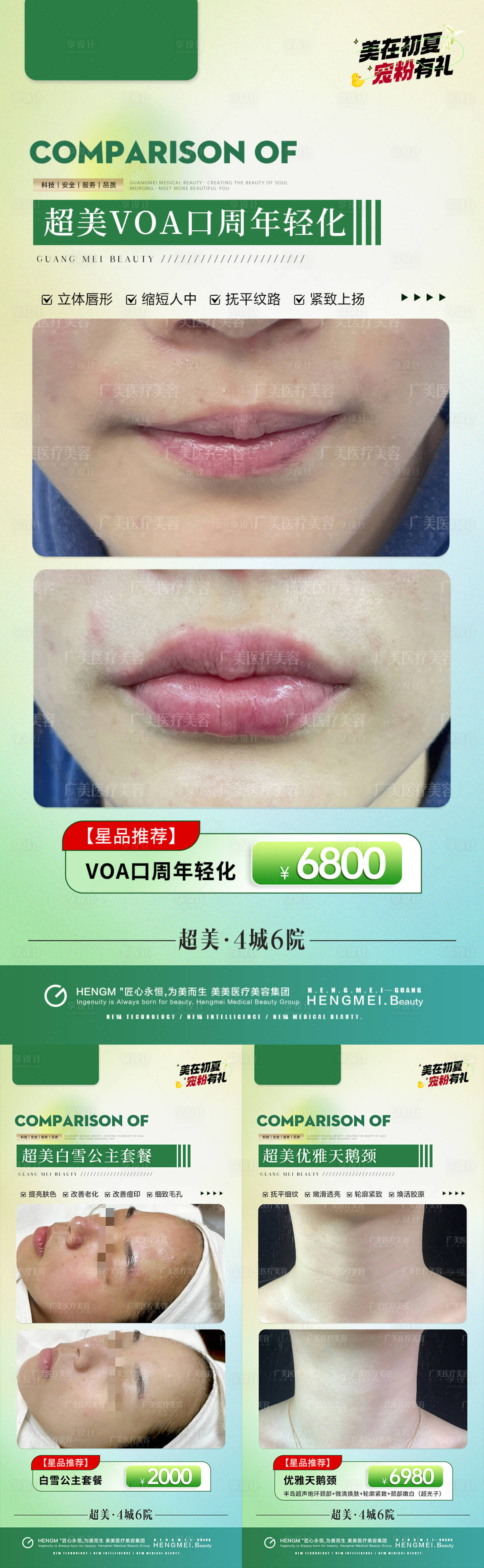 源文件下载【享设计】搜索编号：92300025340721614【医美初夏口周美白天鹅颈案例海报】