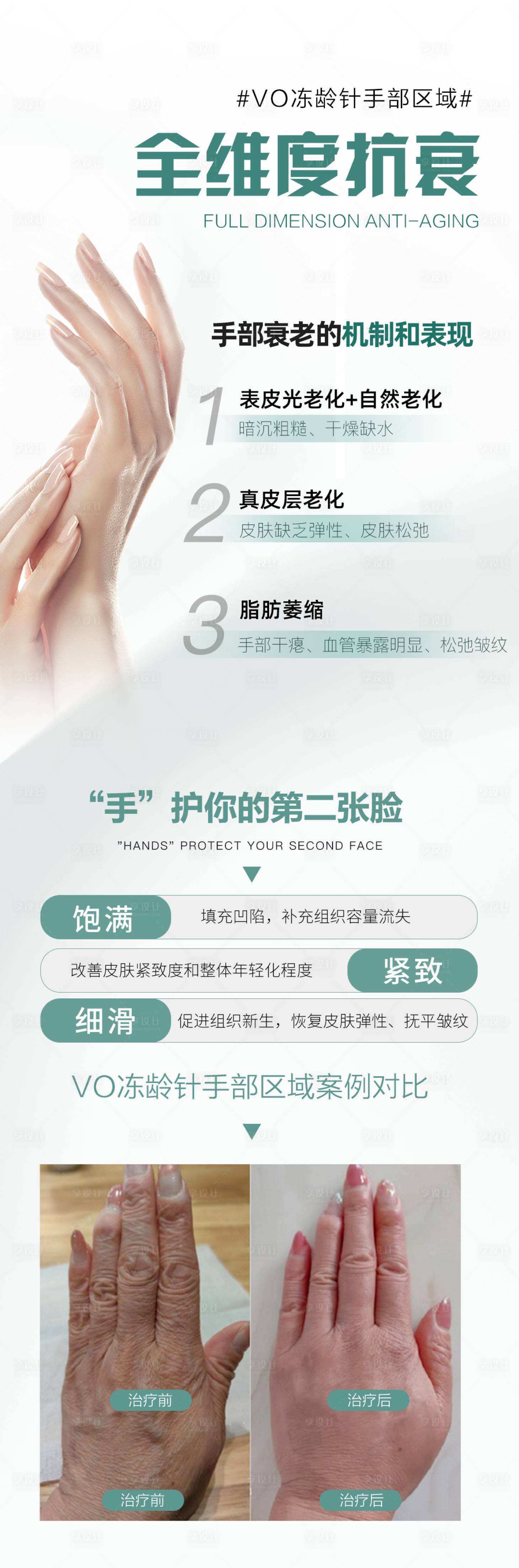 源文件下载【享设计】搜索编号：40990025404885496【医美手部抗衰】