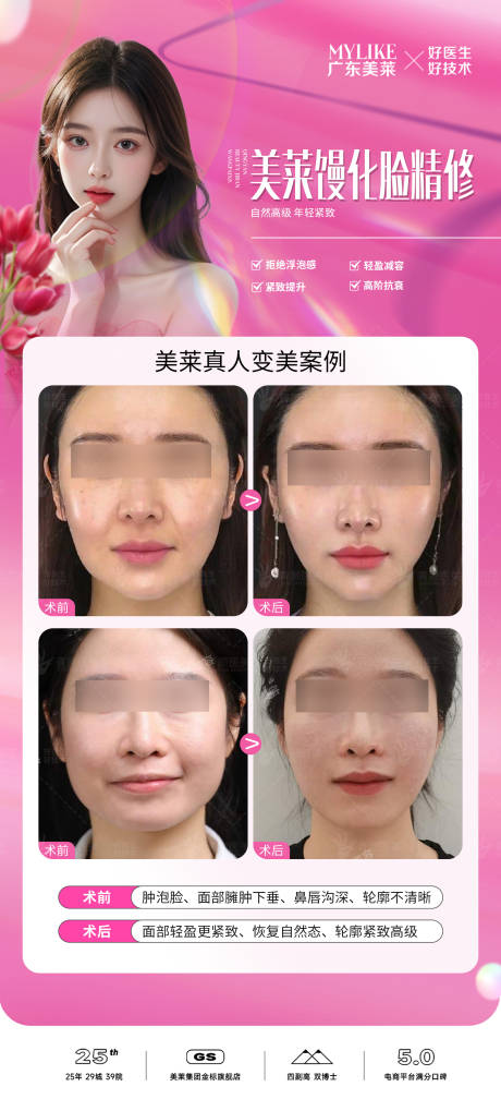 源文件下载【馒化脸修复案例】编号：81880025378607350