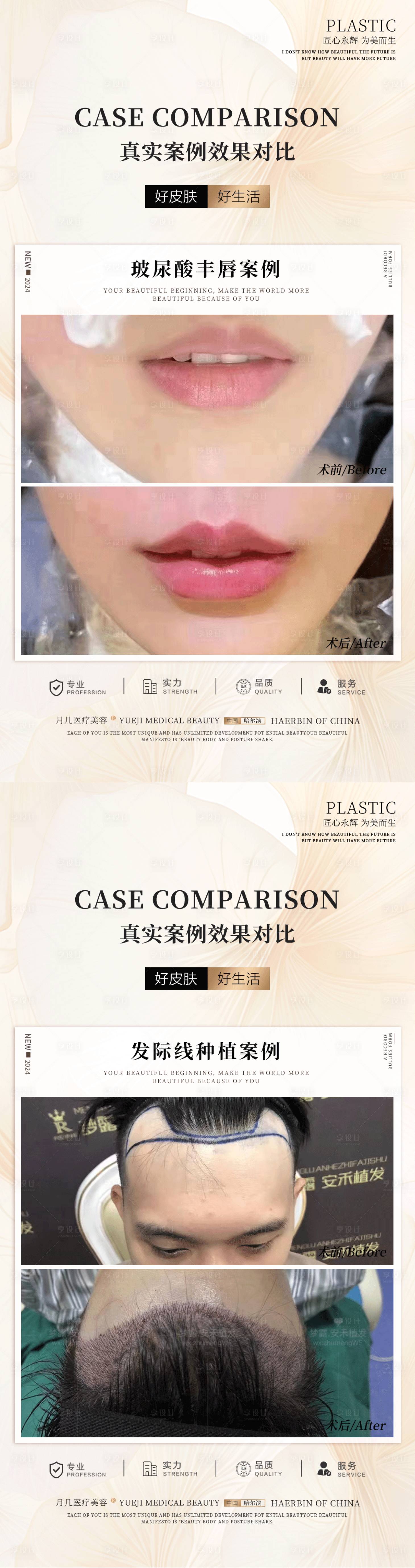 源文件下載【醫(yī)美美容植發(fā)案例海報】編號：11490025113875846