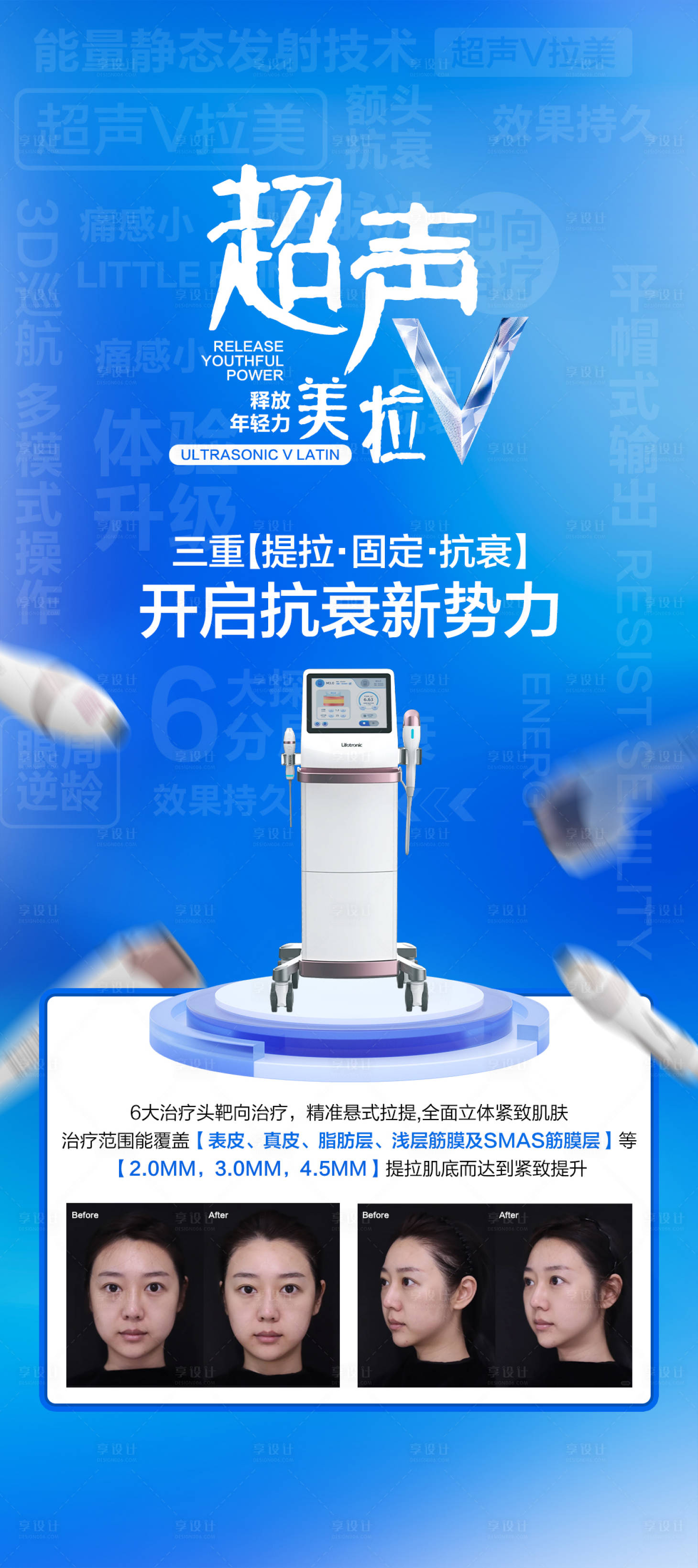 源文件下载【享设计】搜索编号：10970025131078128【超声V拉美】