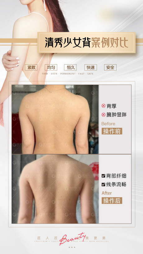 源文件下载【医美案例海报】编号：19530024914705646