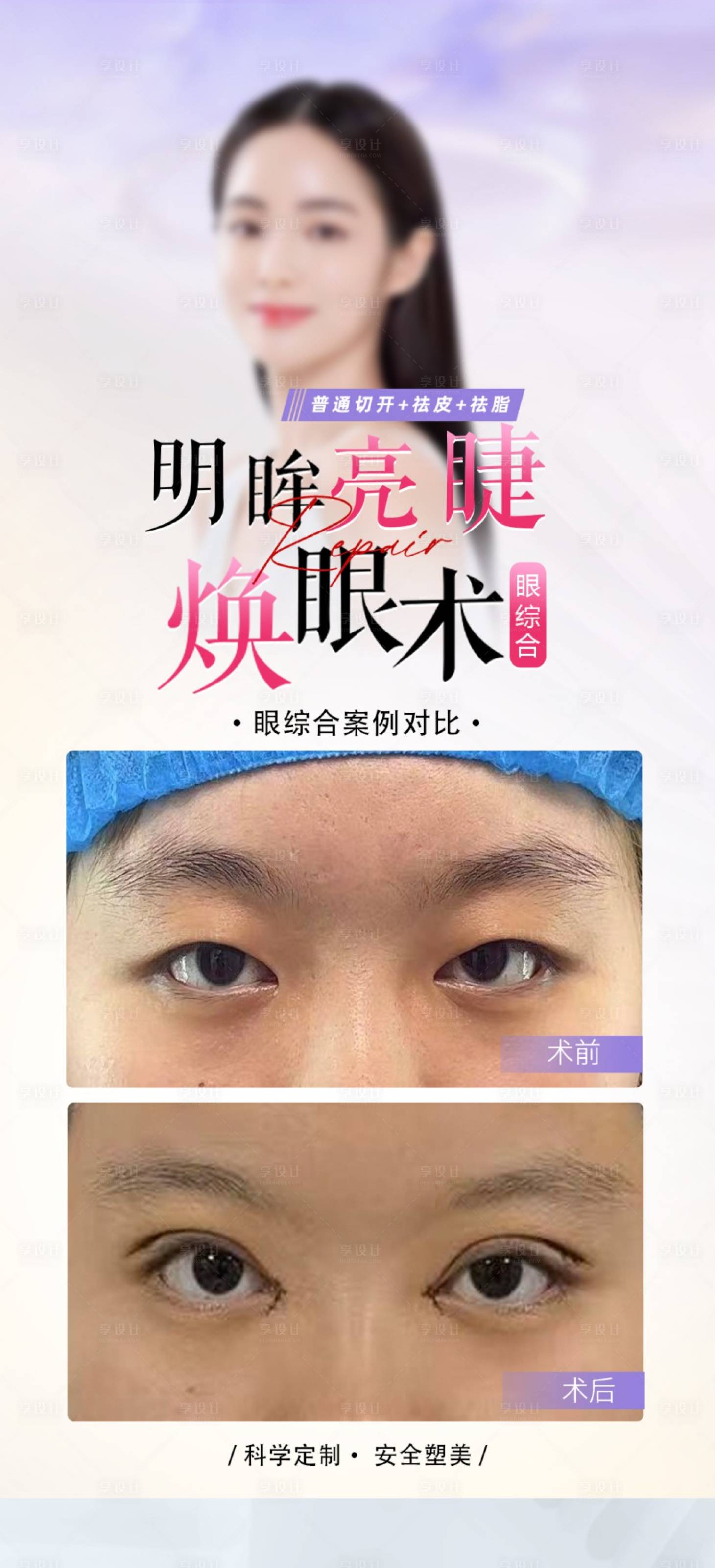 源文件下載【享設計】搜索編號：96010024955596609【眼綜合案例海報】
