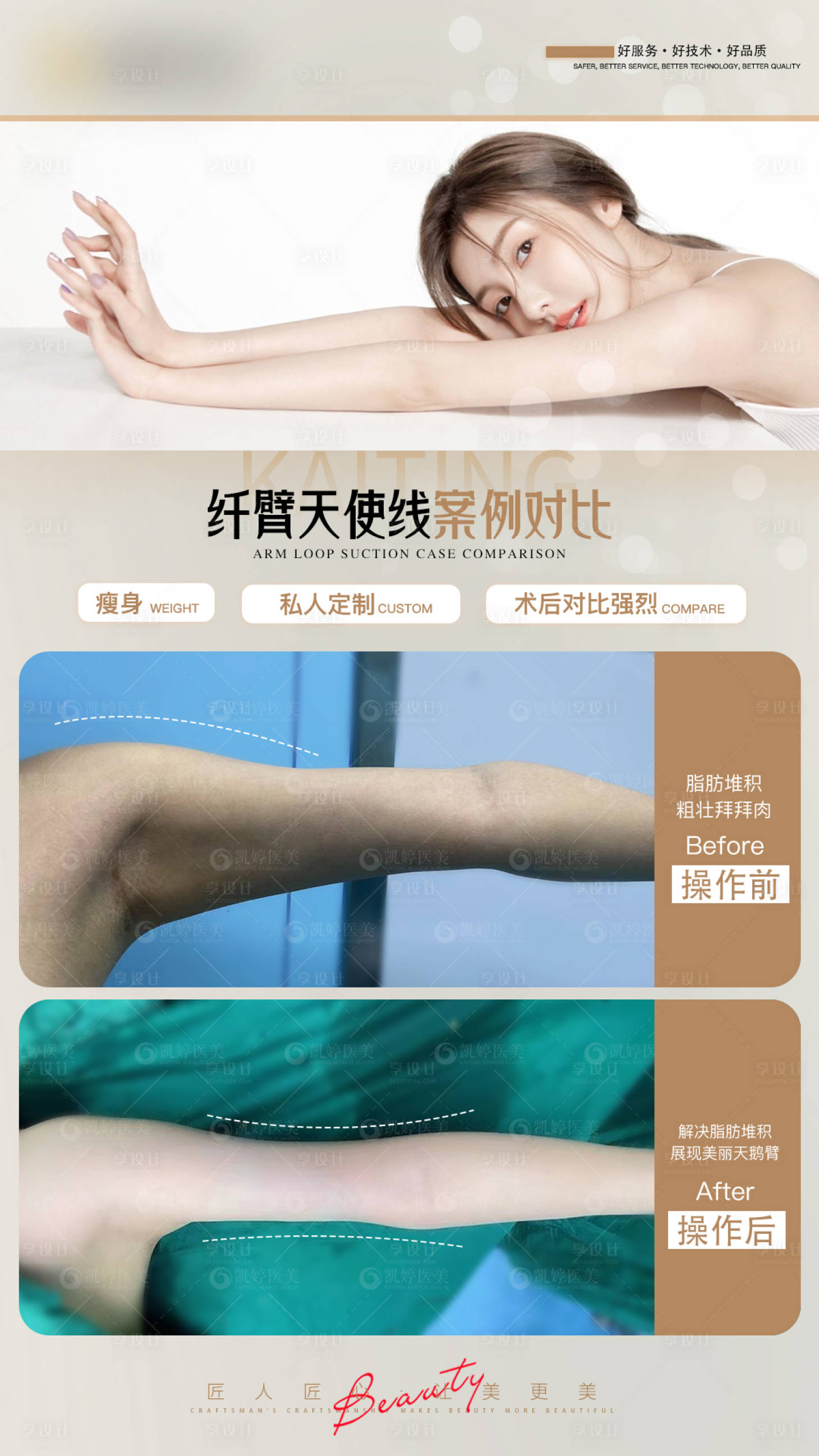 源文件下载【享设计】搜索编号：43140024901835691【医美案例对比图纤臂臂】