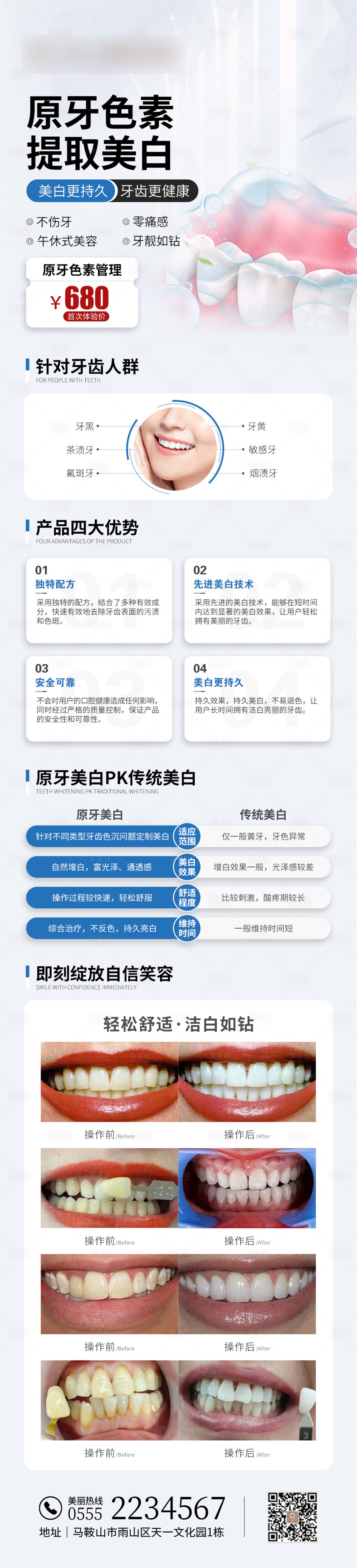 源文件下載【享設(shè)計】搜索編號：85290025336492755【牙齒美白活動長圖】