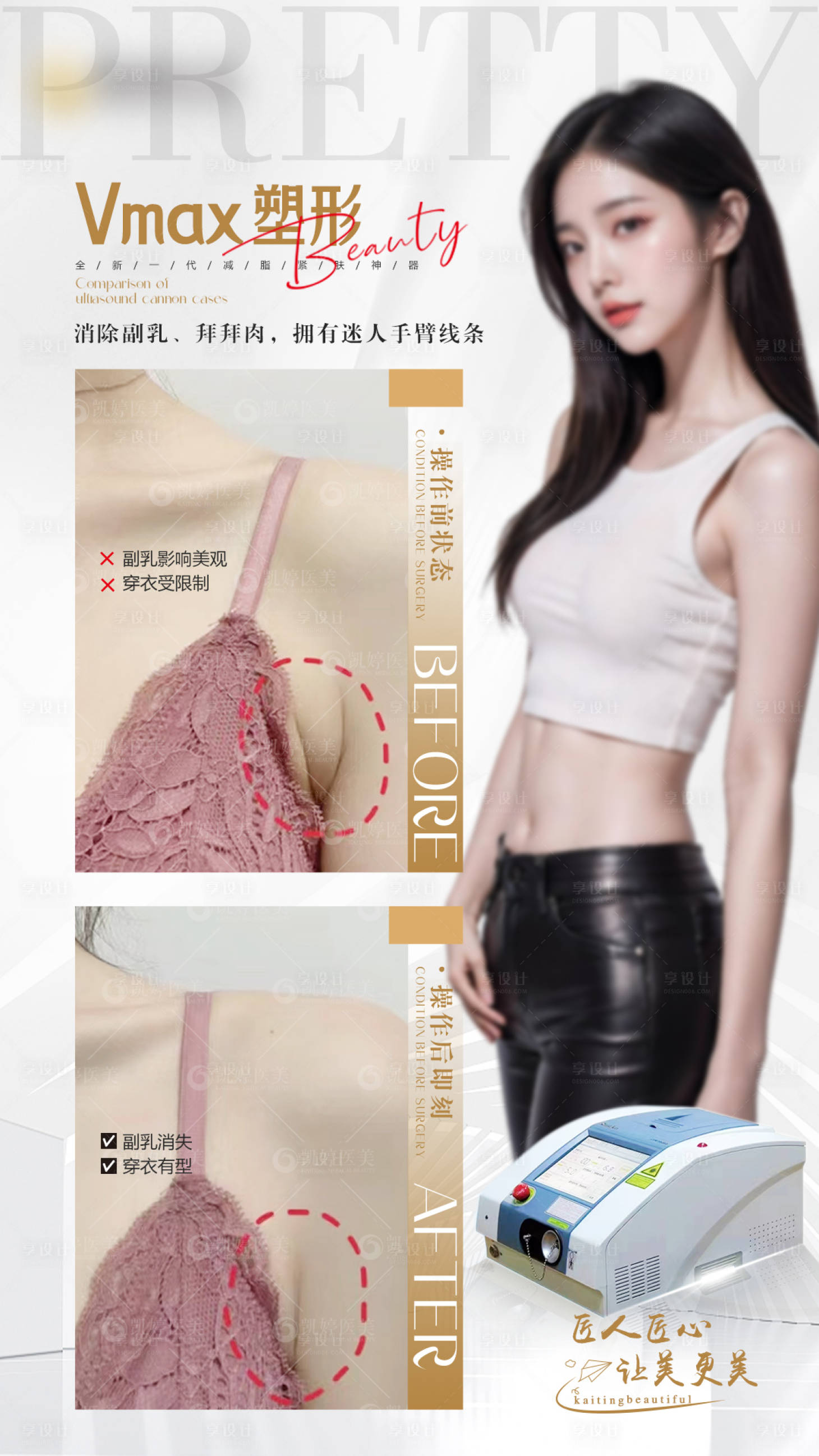源文件下載【享設計】搜索編號：78420025040198657【副乳小顏術 】
