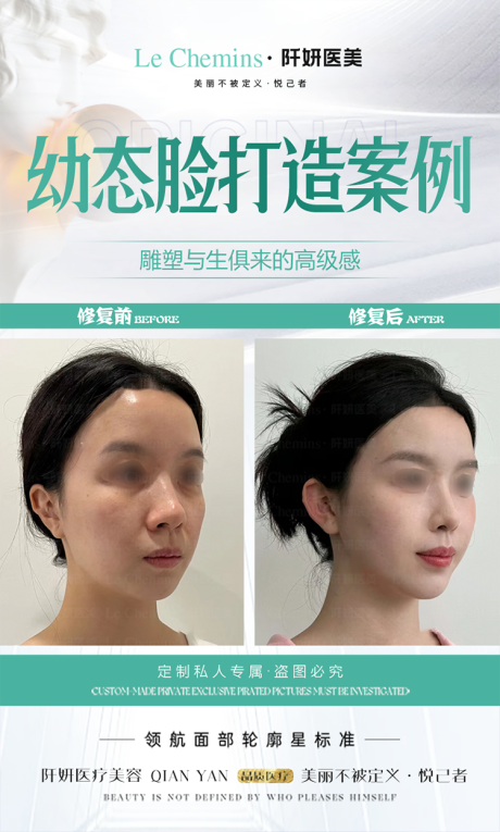 源文件下载【医美幼态脸打造海报】编号：78920025181104860