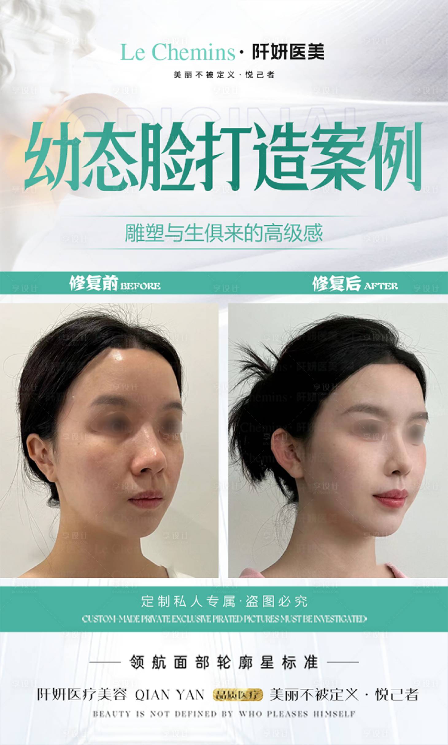 源文件下载【医美幼态脸打造海报】编号：78920025181104860