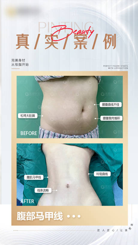源文件下载【医美案例】编号：65500025031898219