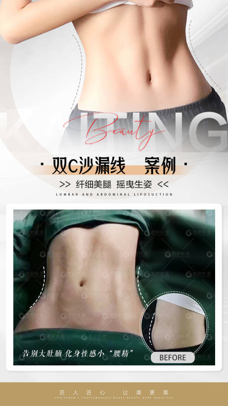 源文件下載【享設計】搜索編號：98860025032445415【醫美案例腰腹對比圖】