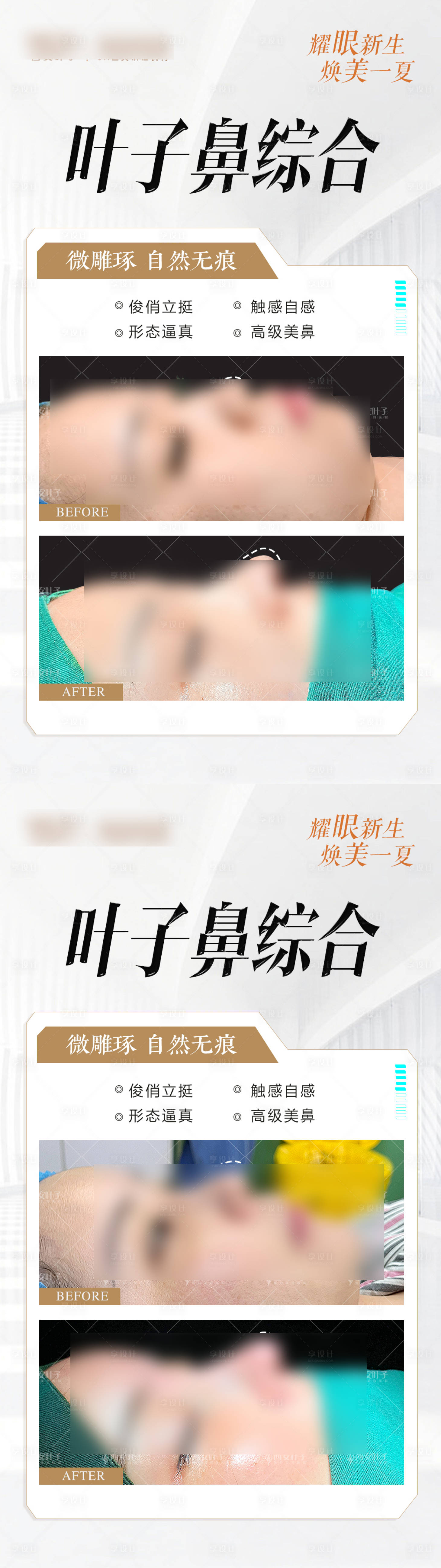 源文件下載【享設計】搜索編號：75910025258948375【鼻整形海報】