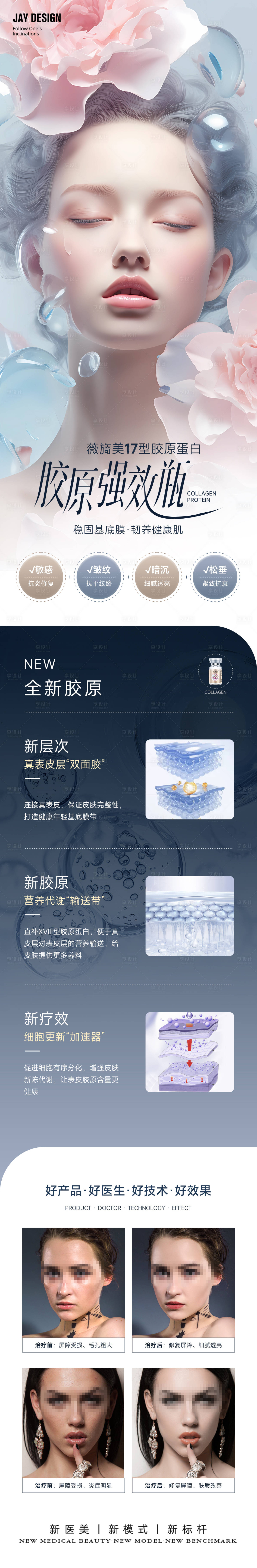 源文件下载【医美薇旖美新品案例长图海报】编号：64920025213983364