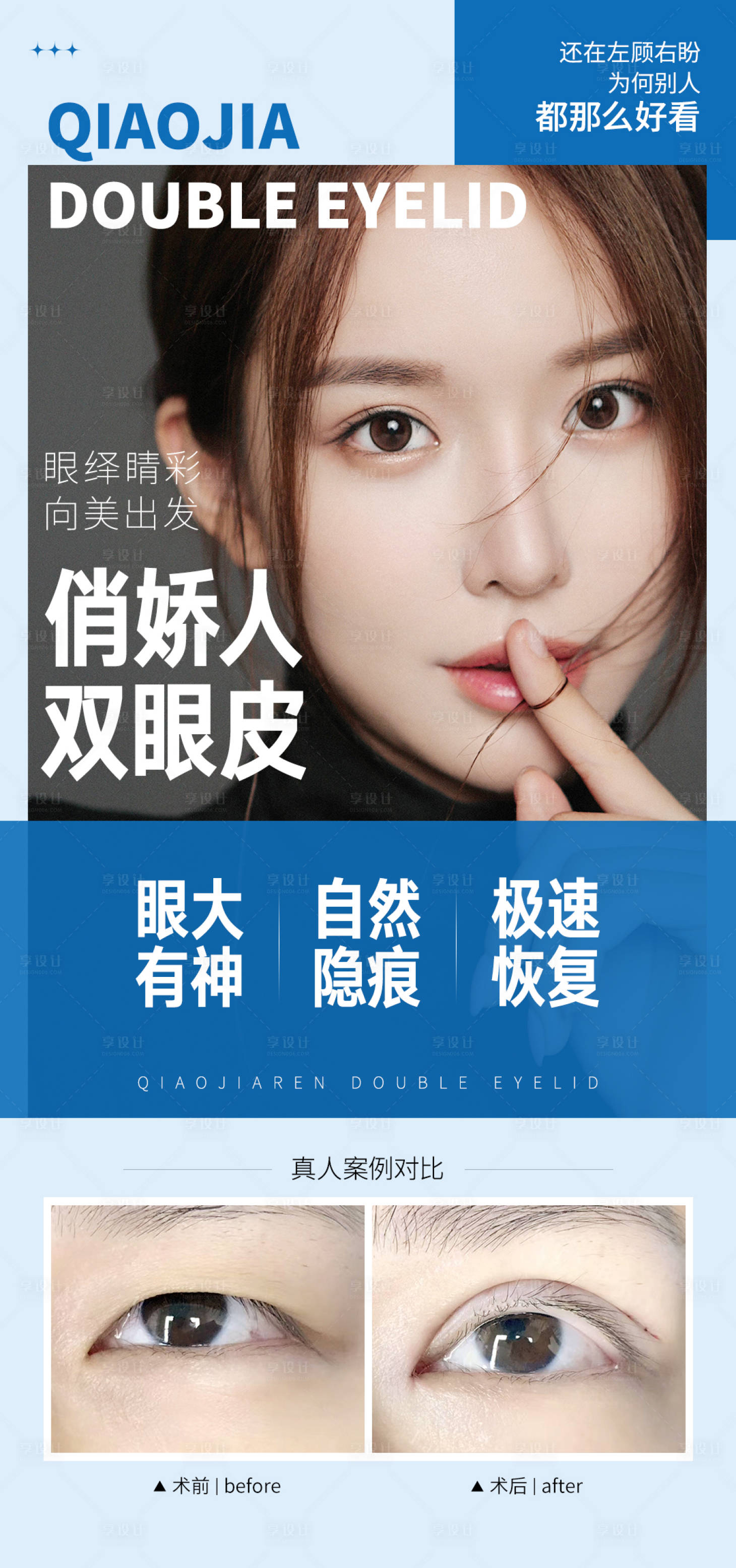 源文件下載【享設計】搜索編號：43350025375029715【雙眼皮案例對比】