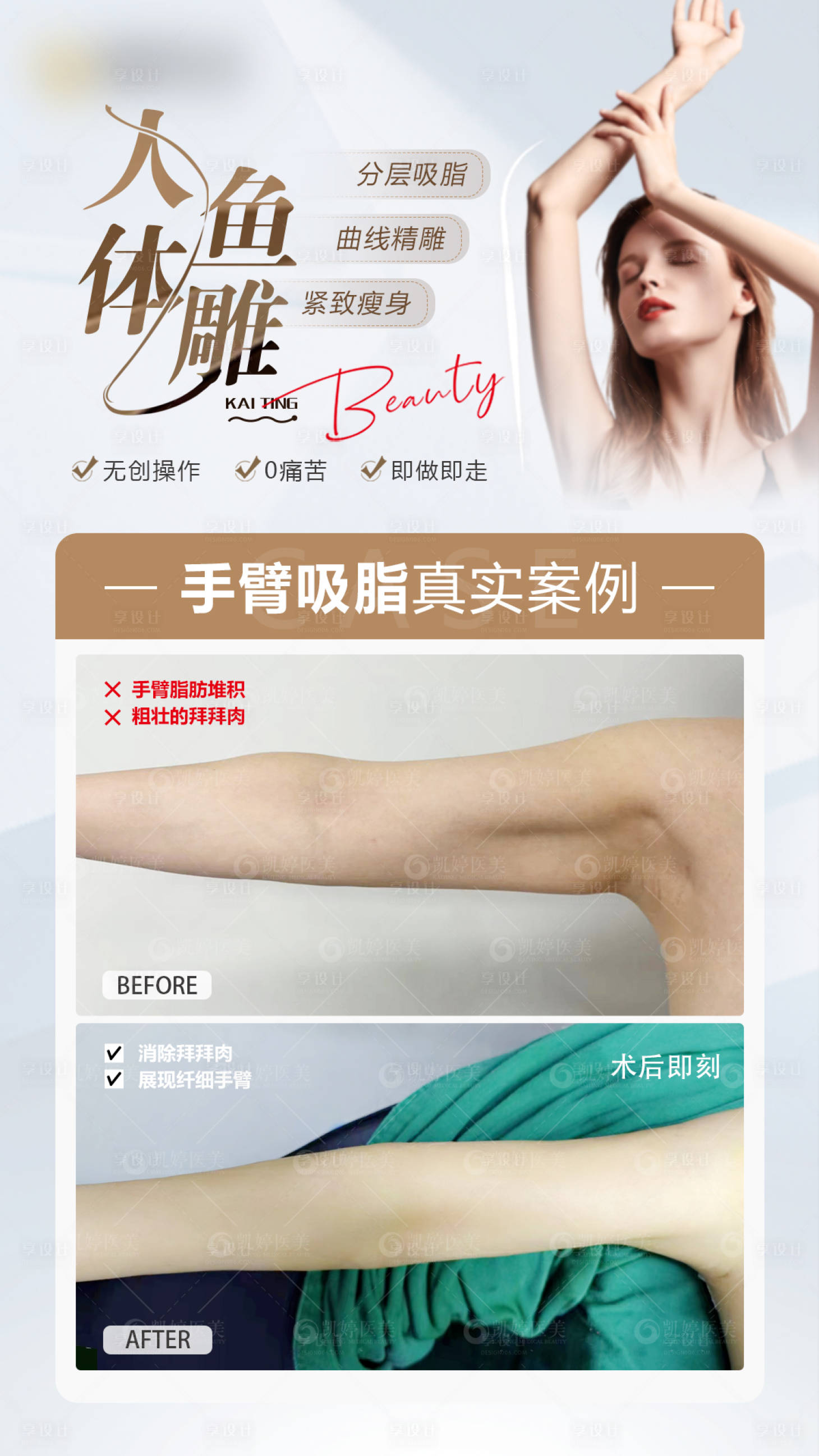 源文件下載【享設計】搜索編號：12500025112865083【醫美案例海報】