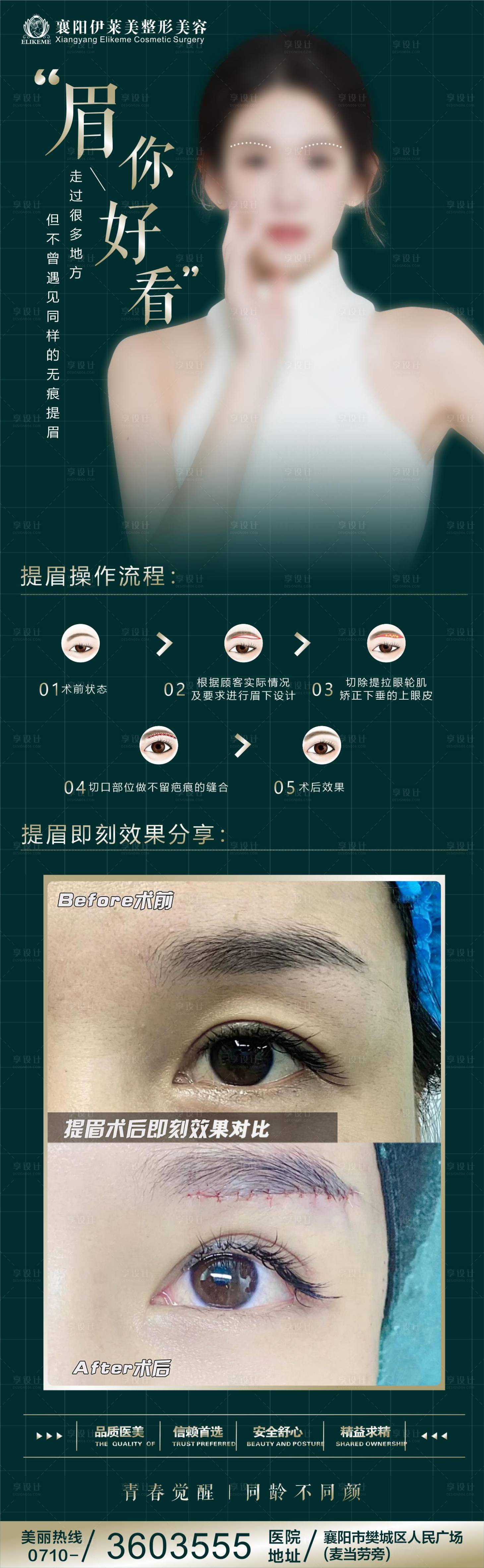 源文件下载【享设计】搜索编号：88430025331502535【医美提眉】