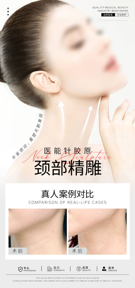源文件下载【享设计】搜索编号：87910024879165621【天鹅颈案例对比海报】