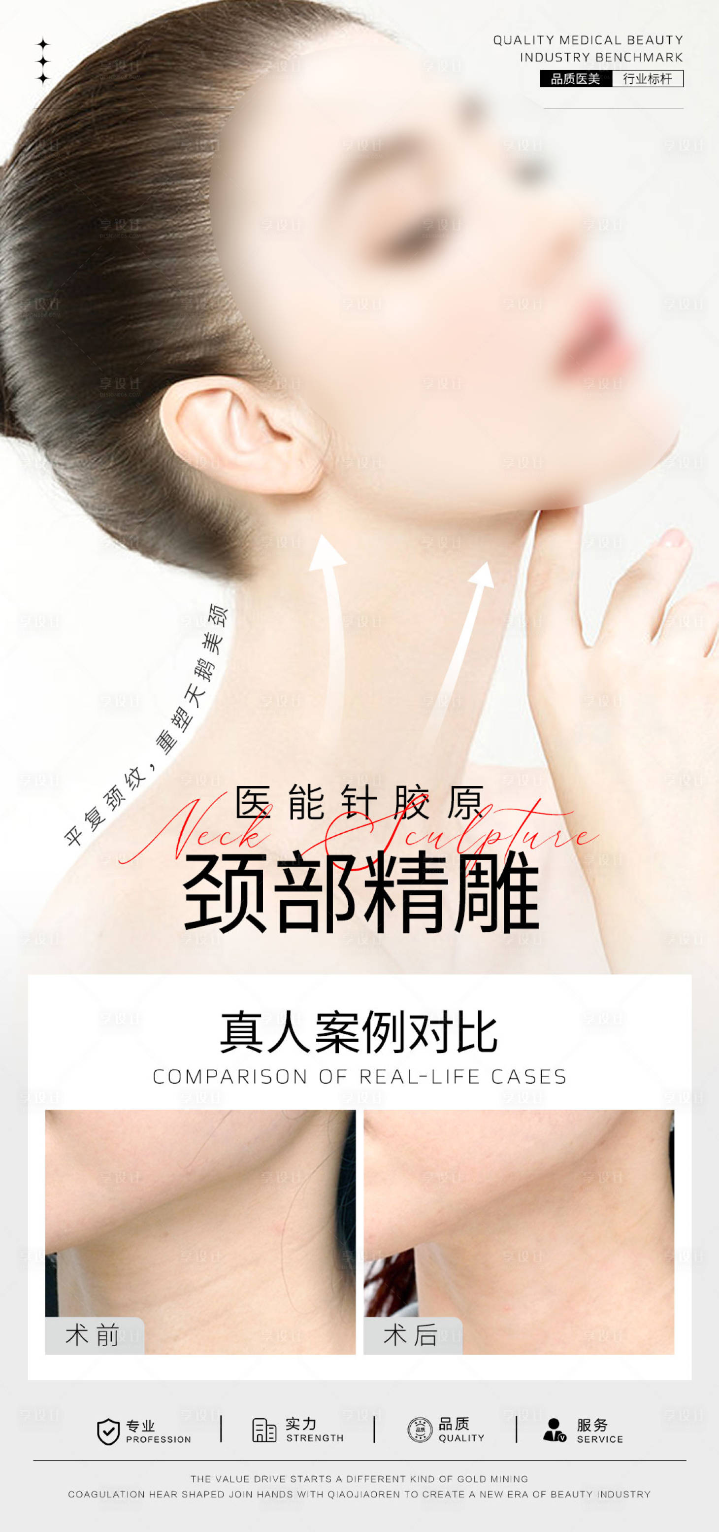 源文件下載【享設(shè)計(jì)】搜索編號(hào)：87910024879165621【天鵝頸案例對(duì)比海報(bào)】