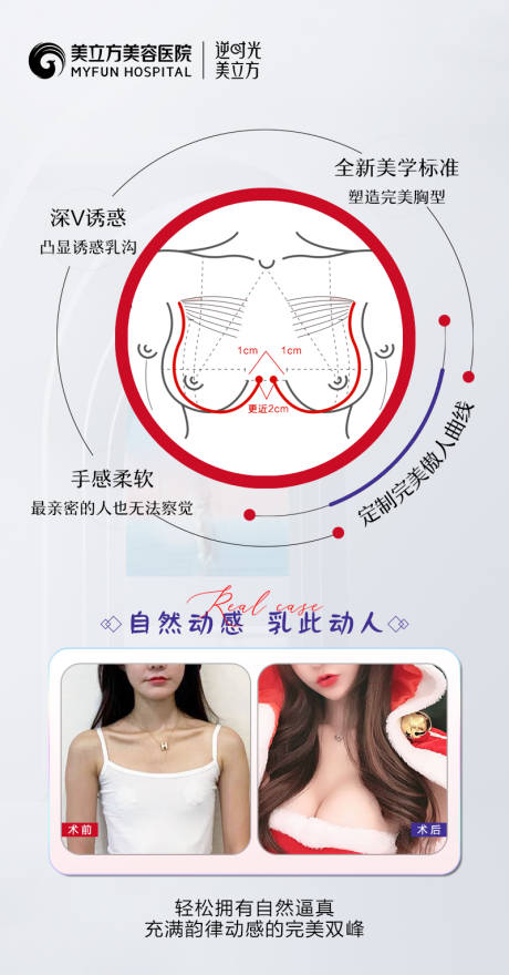 医美整形丰胸隆胸方案分解图案例海报