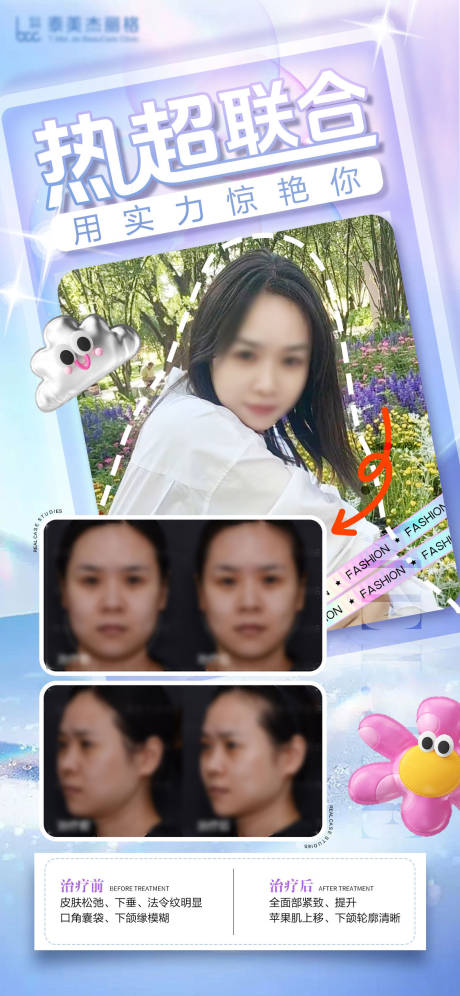 源文件下载【医美热超联合海报】编号：76450025147797340