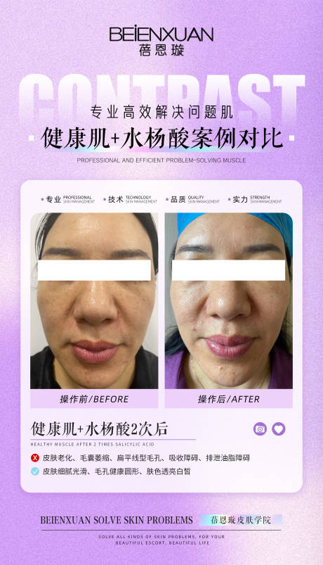 源文件下载【医美案例对比海报】编号：62530025340167544