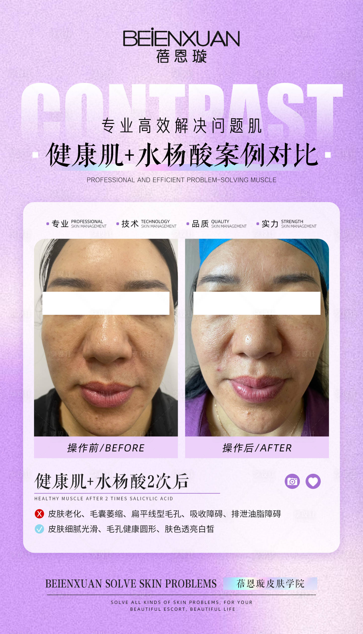 源文件下載【享設計】搜索編號：62530025340167544【醫美案例對比海報】