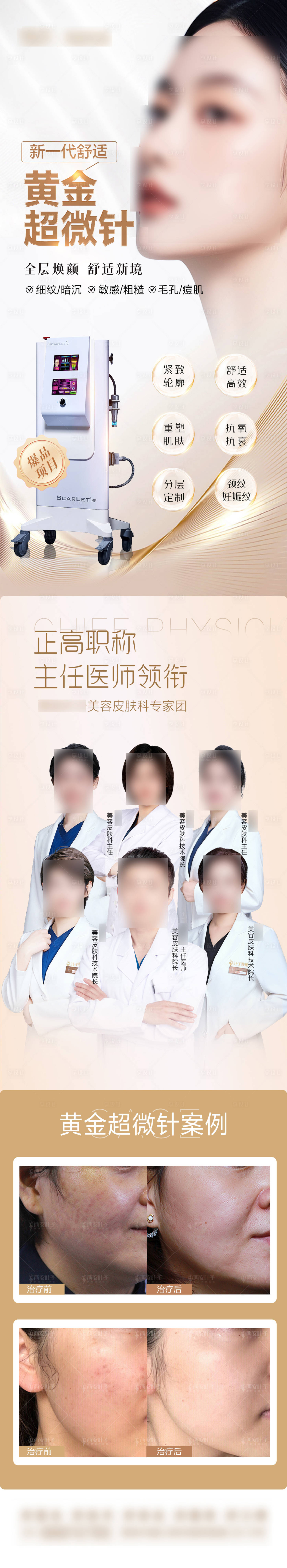 源文件下载【黄金微针长图】编号：35870025214757477