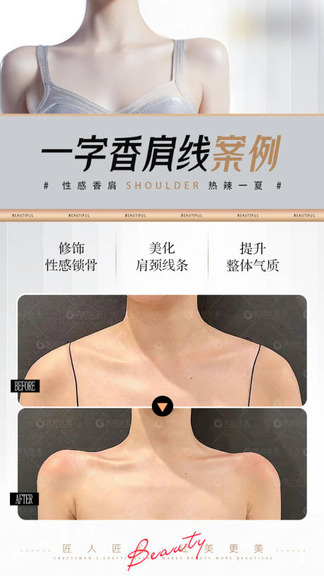 源文件下載【醫美案例對比肩 】編號：57810024901604378