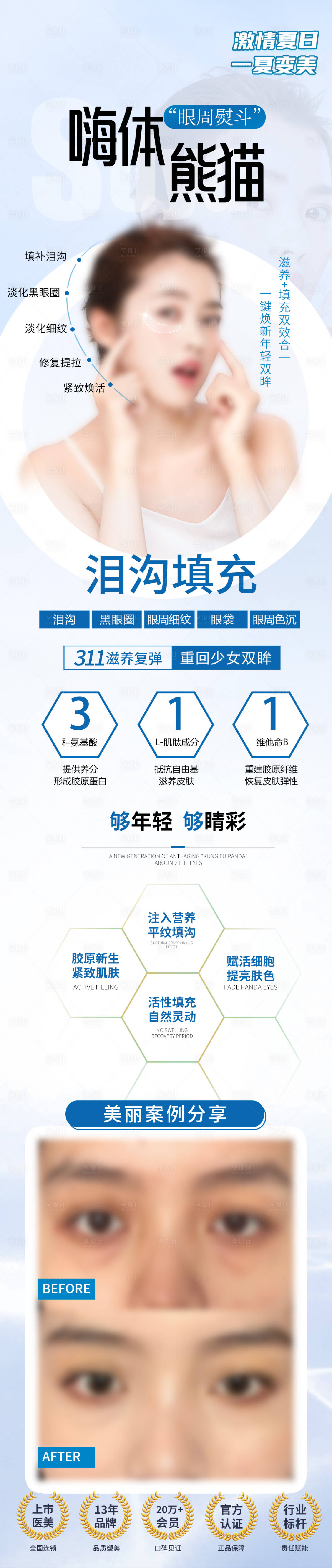 源文件下载【享设计】搜索编号：36120025177939073【泪沟填充】