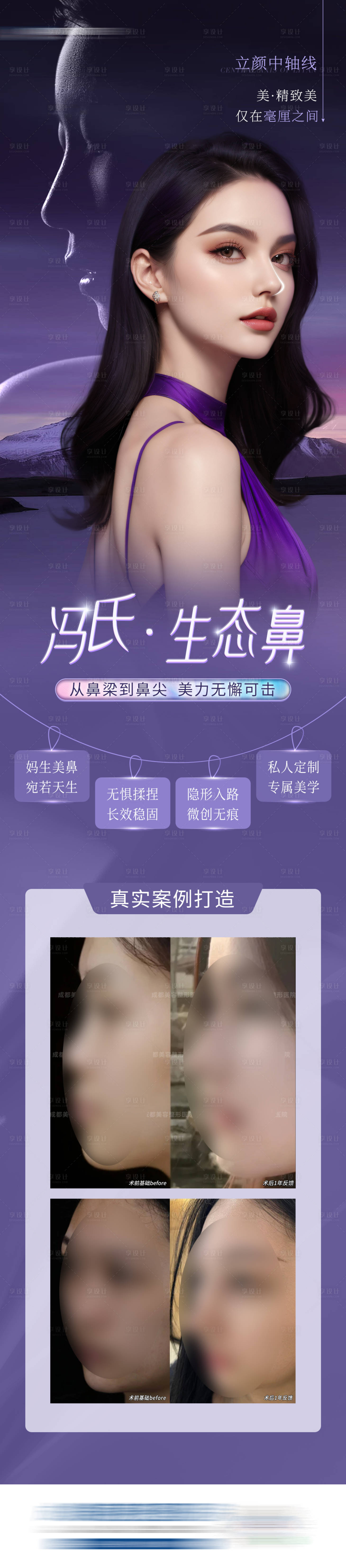 源文件下载【医美鼻整形案例海报】编号：74500025257924372