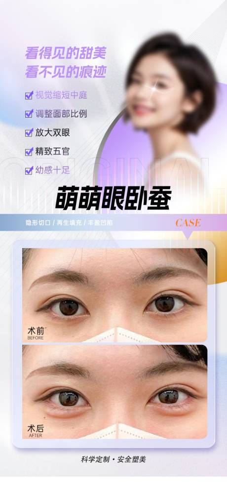 源文件下載【享設計】搜索編號：66820025264948505【臥蠶填充案例海報】