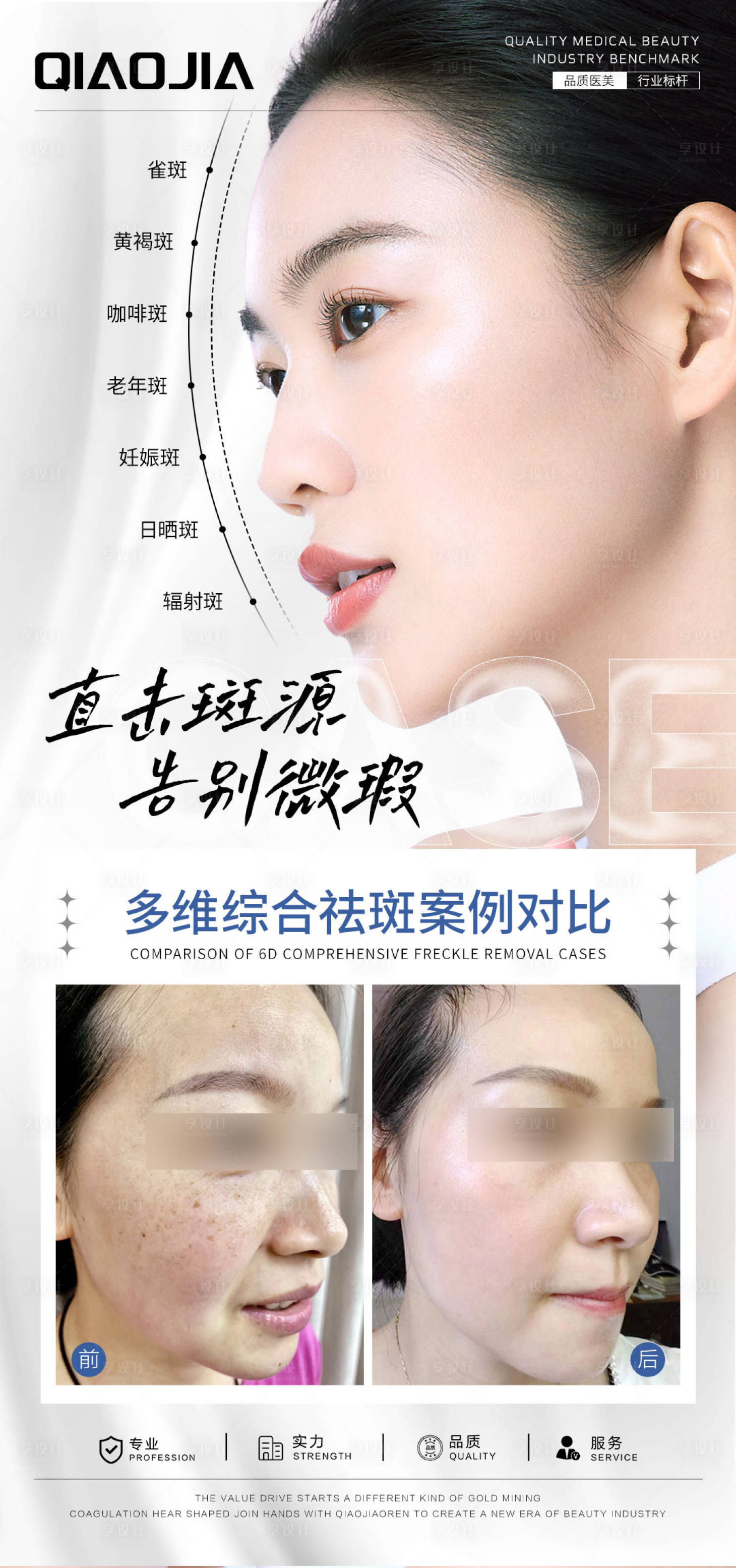 源文件下载【享设计】搜索编号：13850025030861949【祛斑案例对比海报】