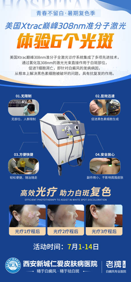 美国Xtra巅峰308nm准分子激光