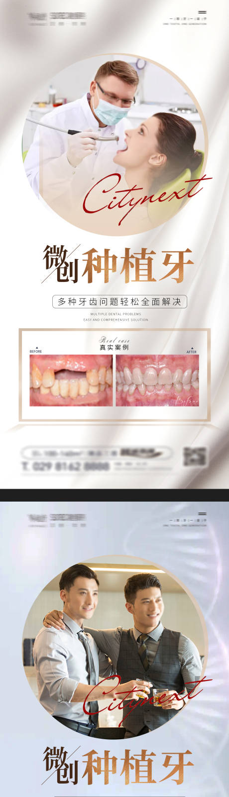 源文件下载【口口腔种植牙案例宣传海报】编号：57940024910182145