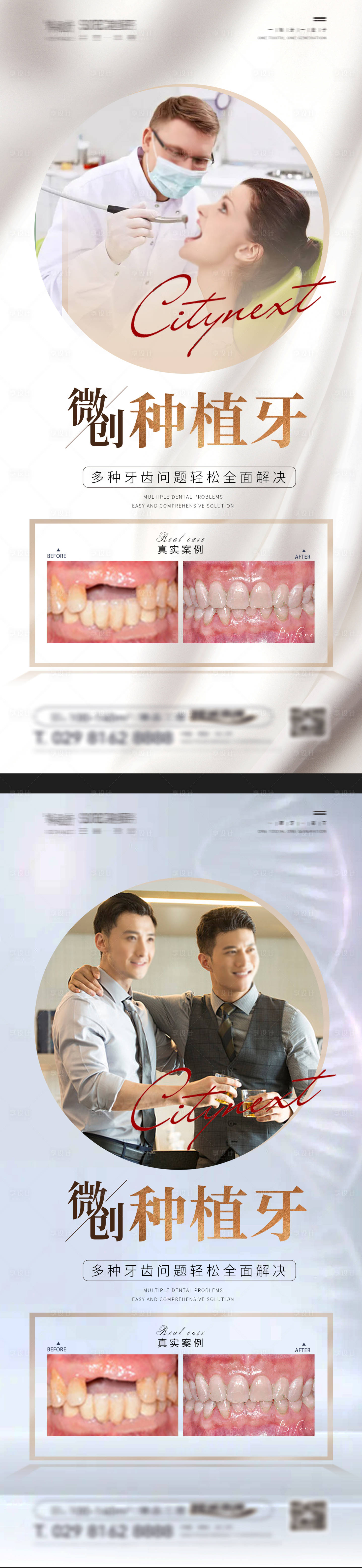 源文件下载【口口腔种植牙案例宣传海报】编号：57940024910182145