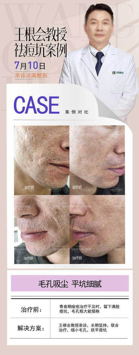 源文件下载【整形美容海报】编号：31450025437003741