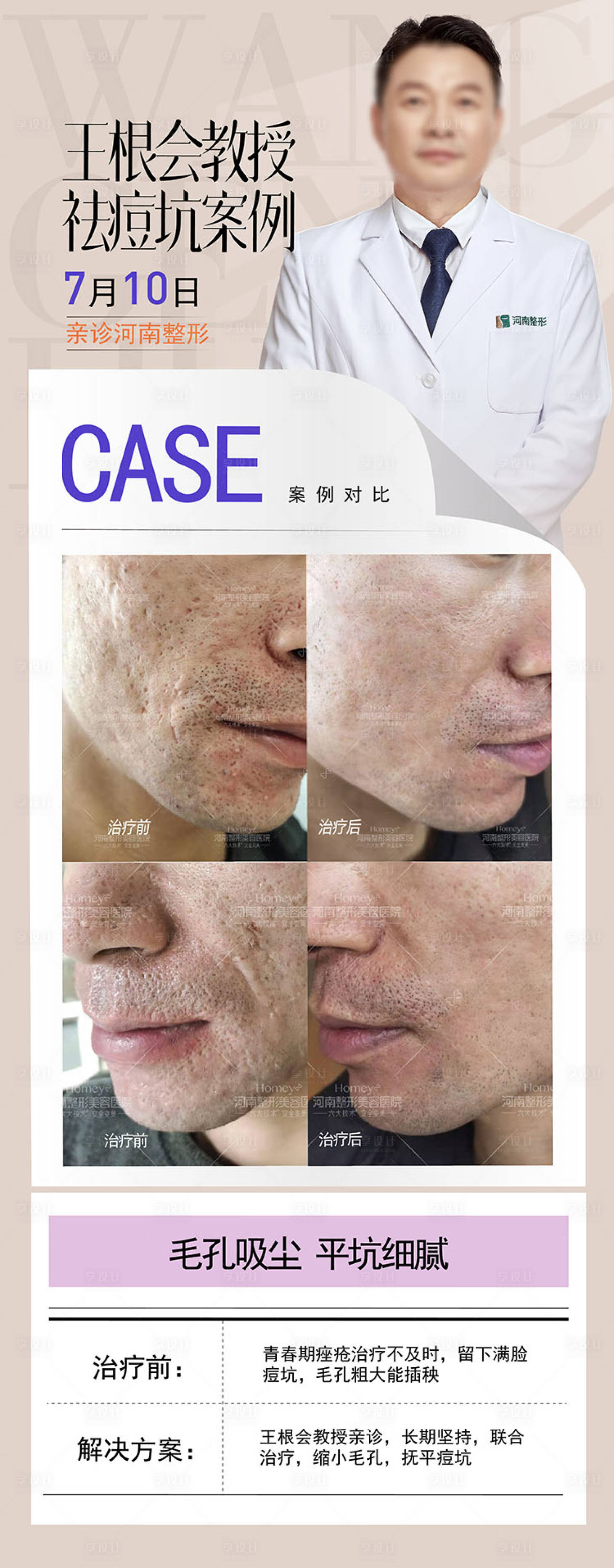 源文件下載【享設(shè)計(jì)】搜索編號(hào)：31450025437003741【整形美容海報(bào)】