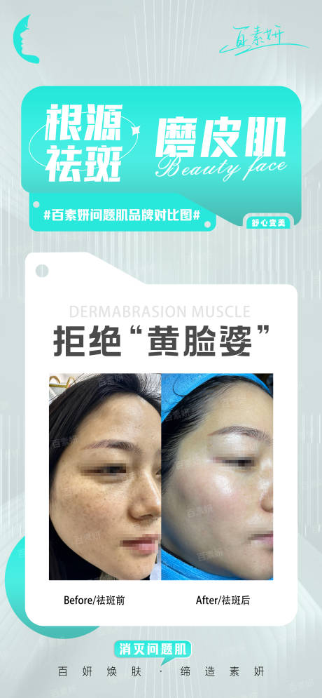 源文件下载【美业产品操作对比图】编号：70330024889655444