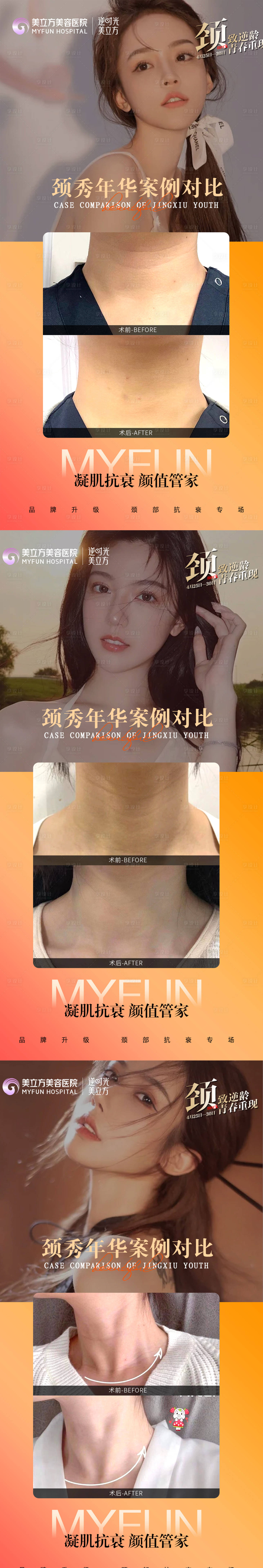 源文件下載【享設計】搜索編號：80970025066388178【醫美整形去頸紋頸案例對比系列海報】
