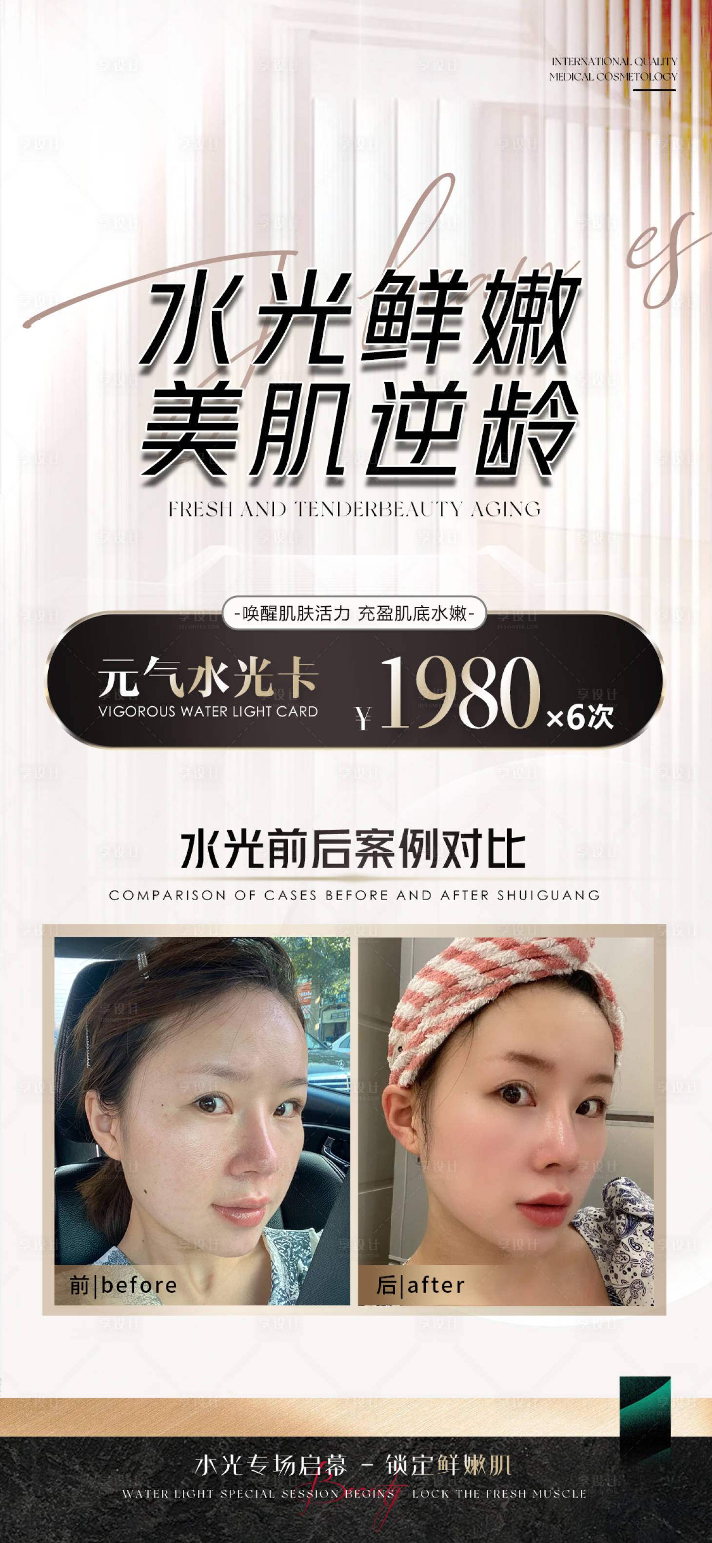 源文件下載【享設計】搜索編號：95480025281516455【醫美水光活動卡項宣傳海報】