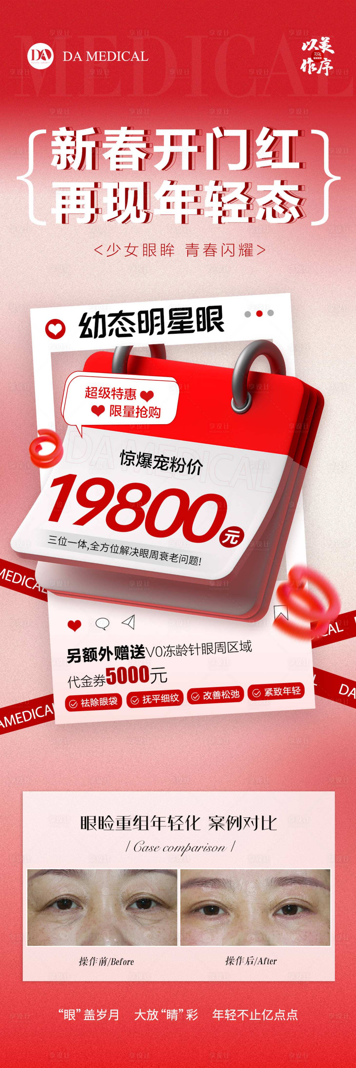 源文件下载【享设计】搜索编号：86280025428677858【医美新春幼态眼部长图活动】