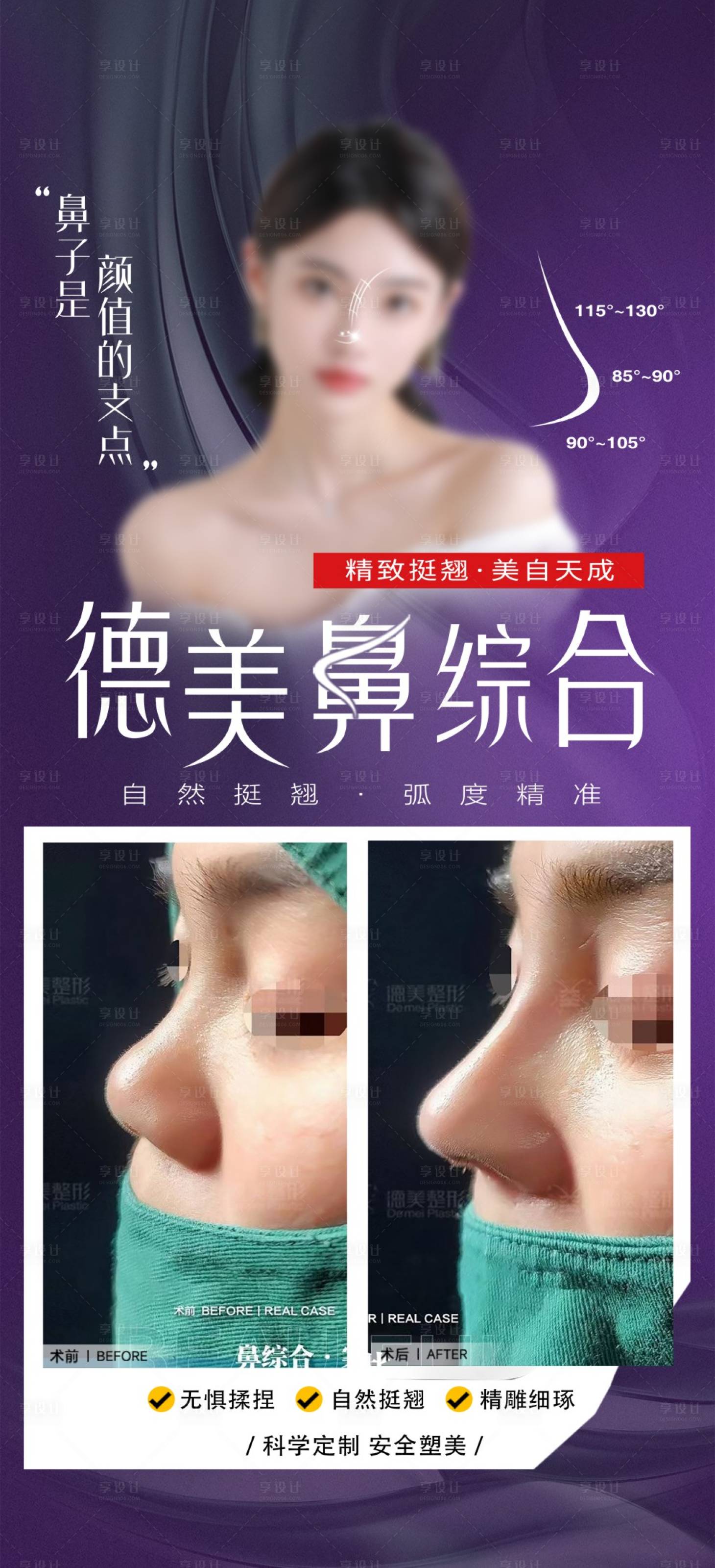 源文件下载【享设计】搜索编号：35520024926461104【鼻综合案例海报】