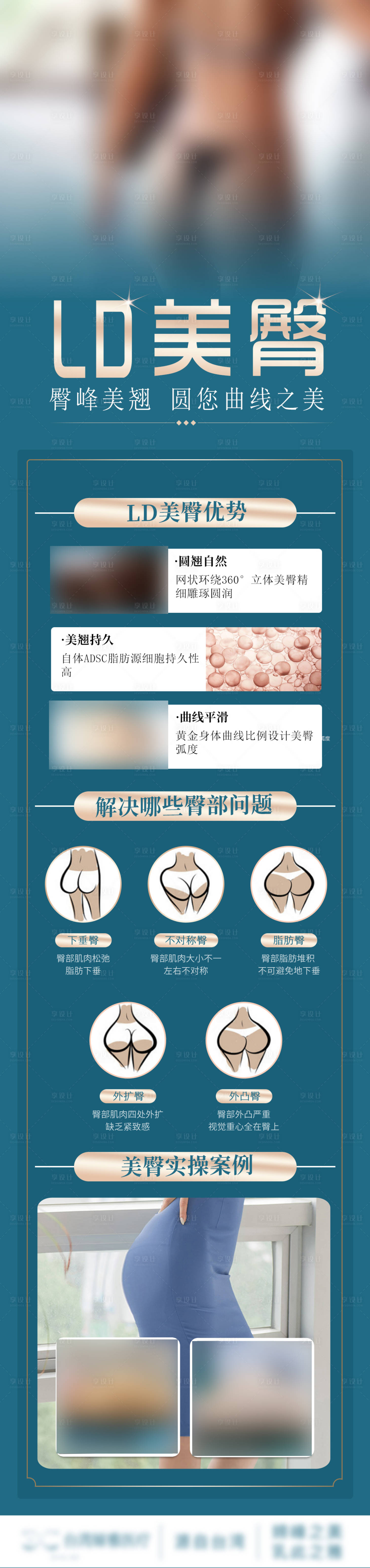 源文件下载【享设计】搜索编号：33370022442675279【医美美臀长图】