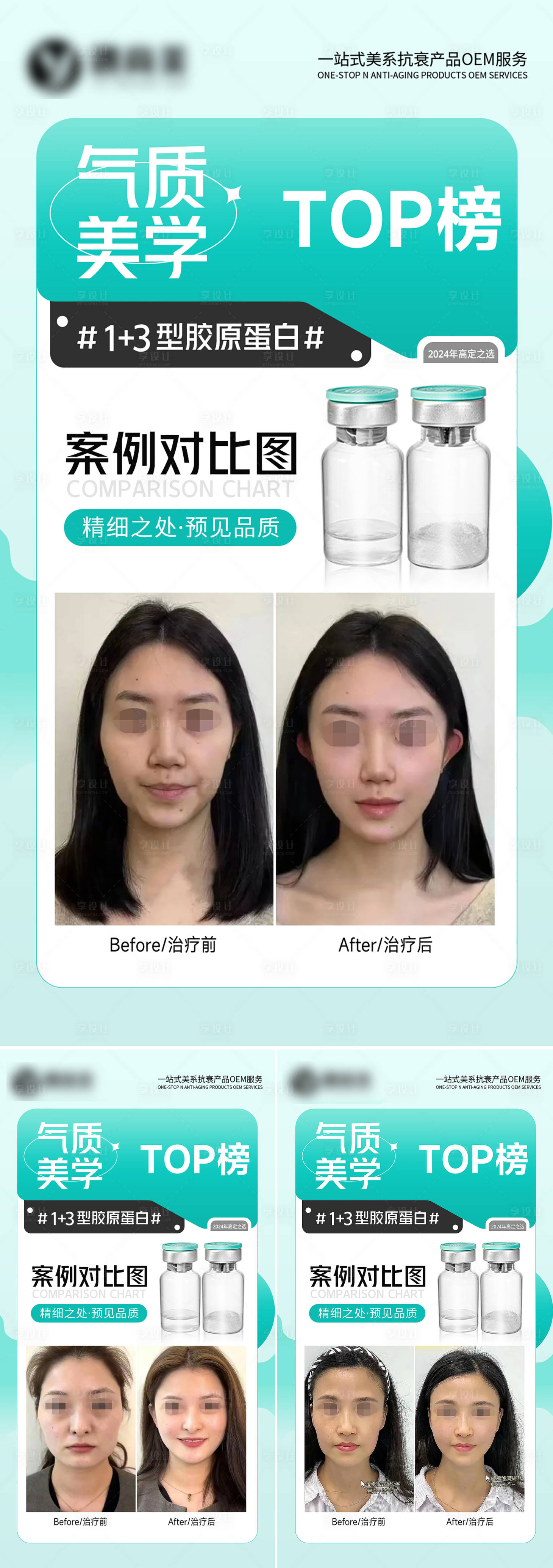 源文件下载【享设计】搜索编号：21530025055135994【医美案例对比图系列海报】